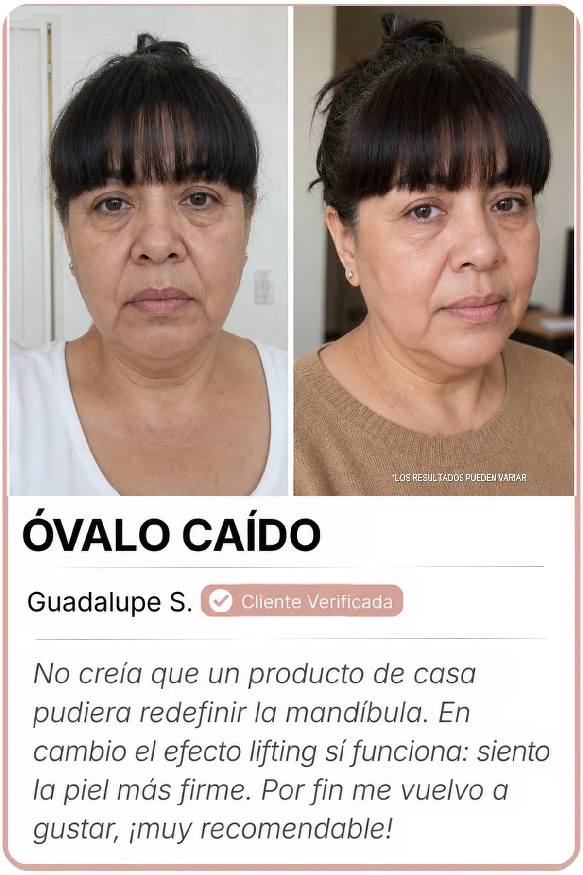 Antes y después Sedanza — Óvalo caído, Guadalupe S.