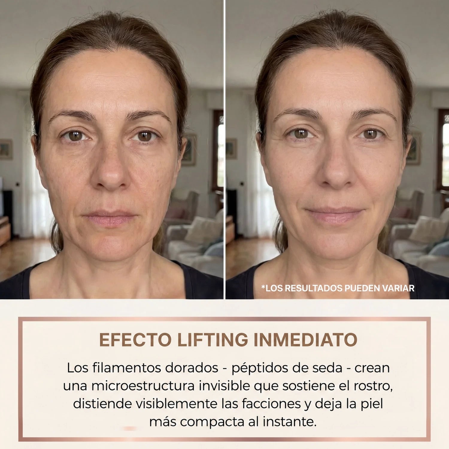 SEDANZA – Suero Coreano Efecto Lifting desde la Primera Aplicación