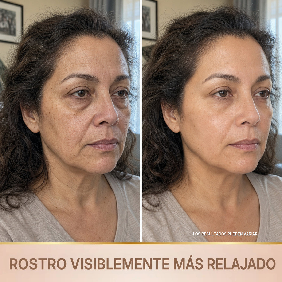 Rostro visiblemente mas relajado - antes y despues