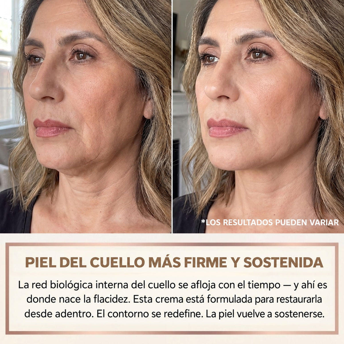 Piel del cuello más firme y sostenida