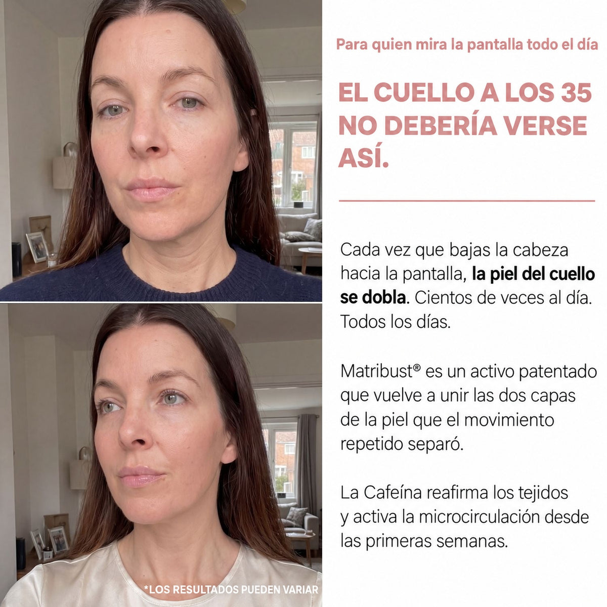 El cuello a los 35